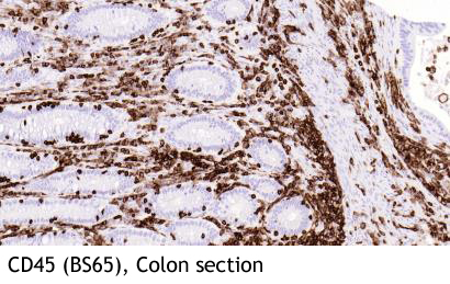Anti-CD45 (Clone BS65)